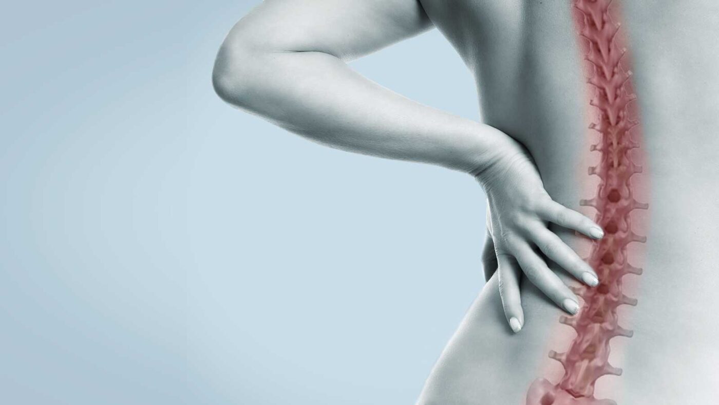 Rückenschmerzen an der Wirbelsäule sind oft schmerzhaft. © underdogstudios/fotolia.com